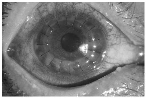 A desiccator for maintaining corneal setting and method for maintaining corneal setting