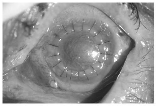 A desiccator for maintaining corneal setting and method for maintaining corneal setting