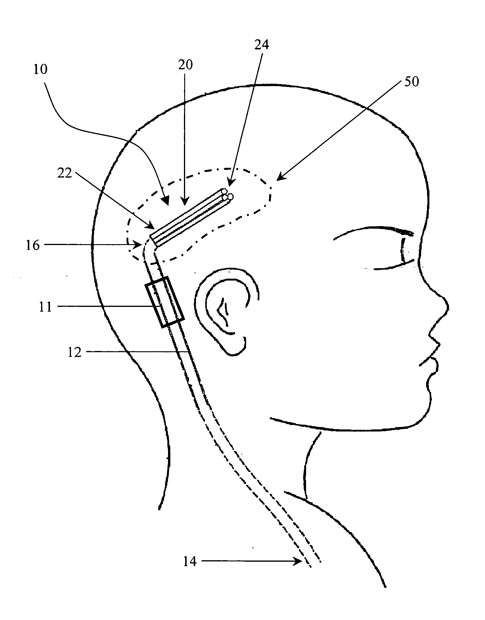 Multi-catheter insertion device and method