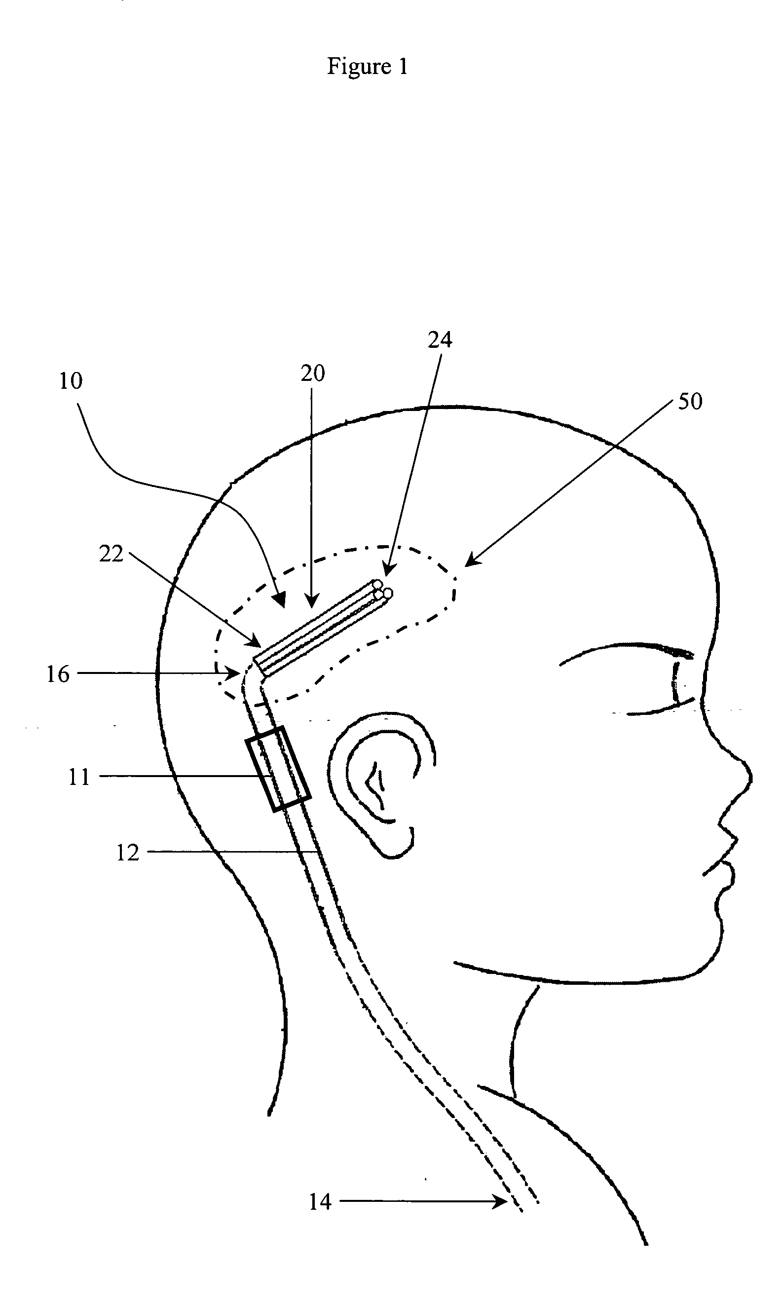 Multi-catheter insertion device and method