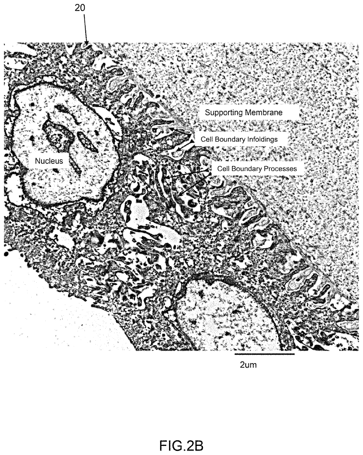 Amnion derived therapeutic compositions and methods of use