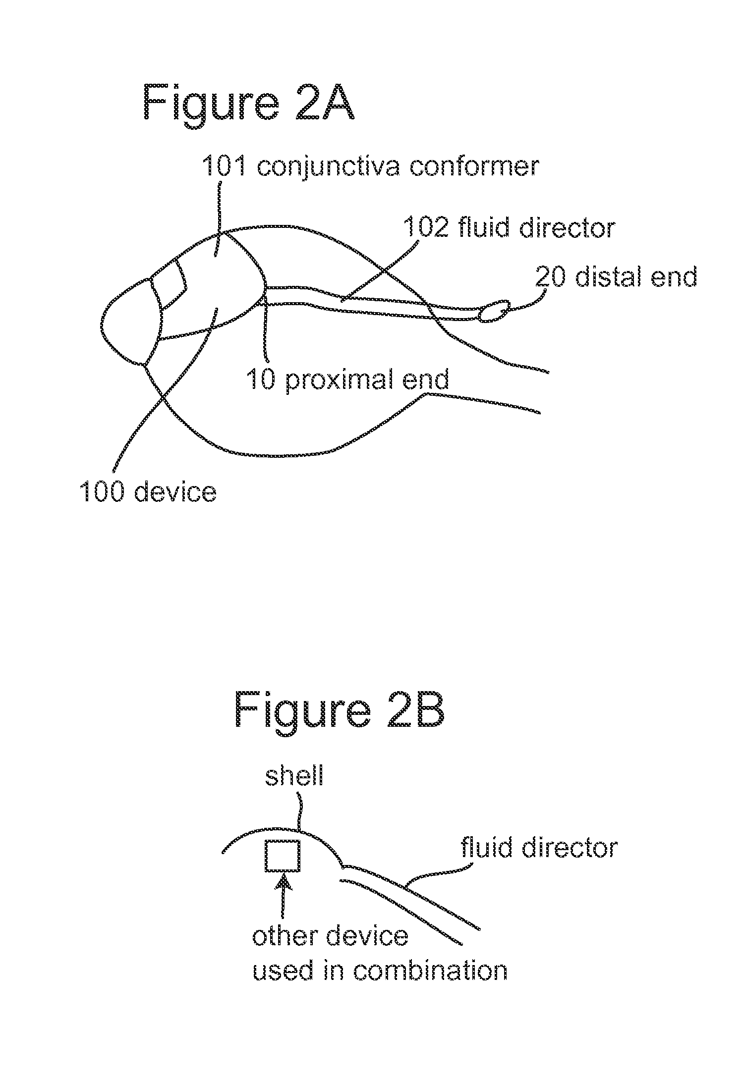 Subconjunctival conformer device and uses thereof