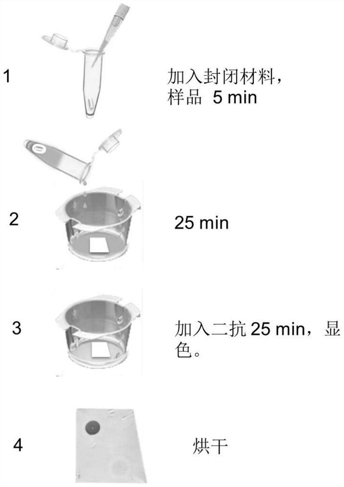 Detection material, preparation method and application of anti-gababr autoantibody in human body fluid