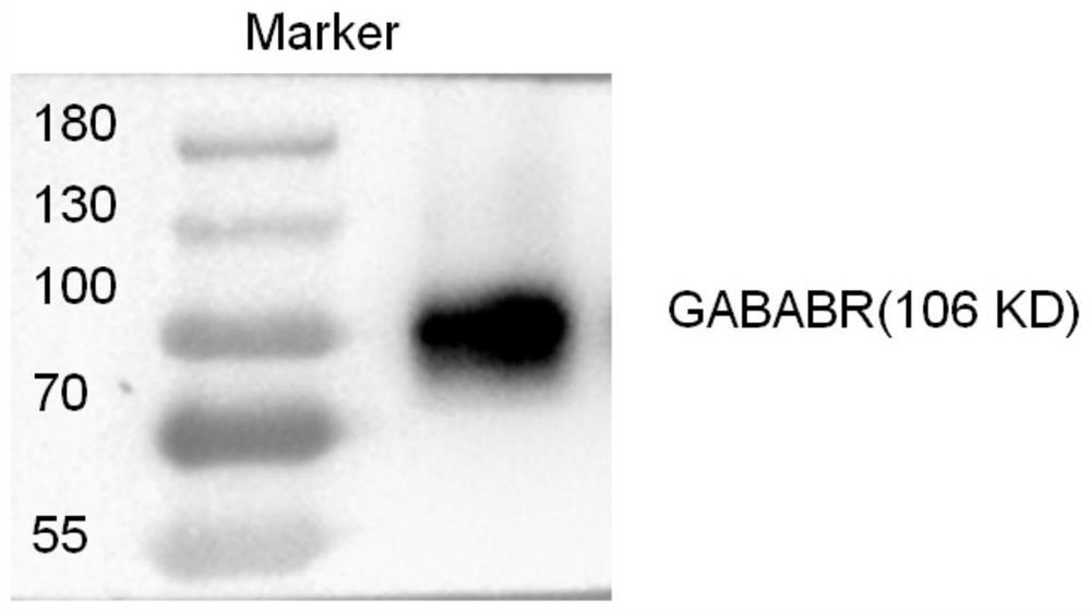 Detection material, preparation method and application of anti-gababr autoantibody in human body fluid