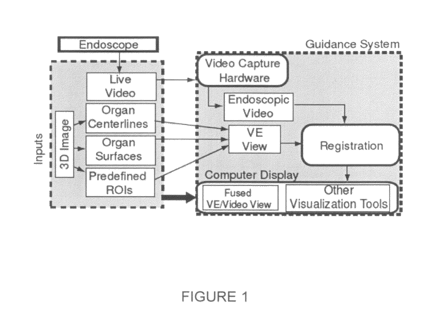 Method and apparatus for continuous guidance of endoscopy