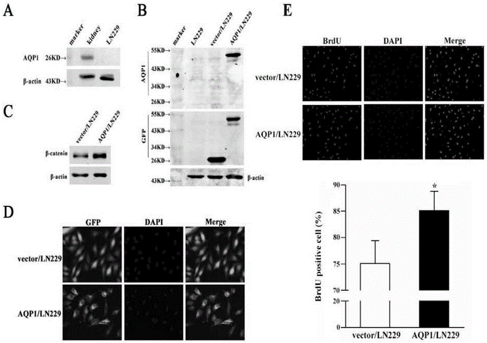 Positive relationship of AQP1 expression and beta-catenin expression