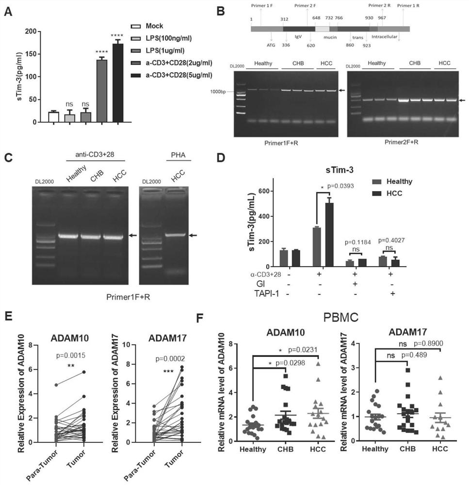 Soluble form of tim3 in immune checkpoint blockade therapy resistance