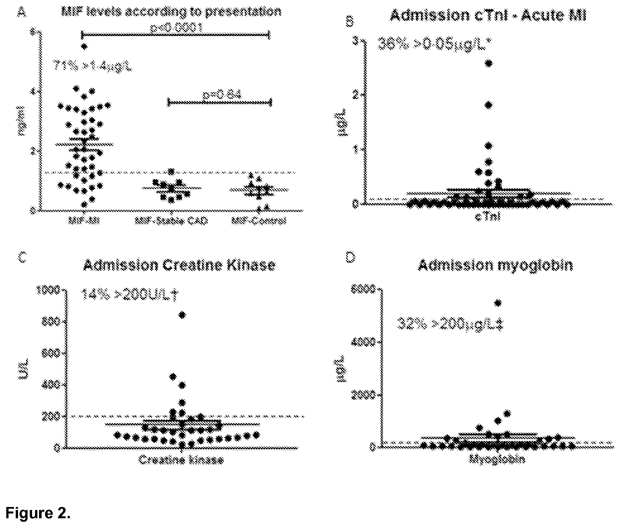Method for diagnosis, prognosis or treatment of acute coronary syndrome (ACS) comprising measurement of plasma concentration of macrophage migration inhibitory factor (MIF)