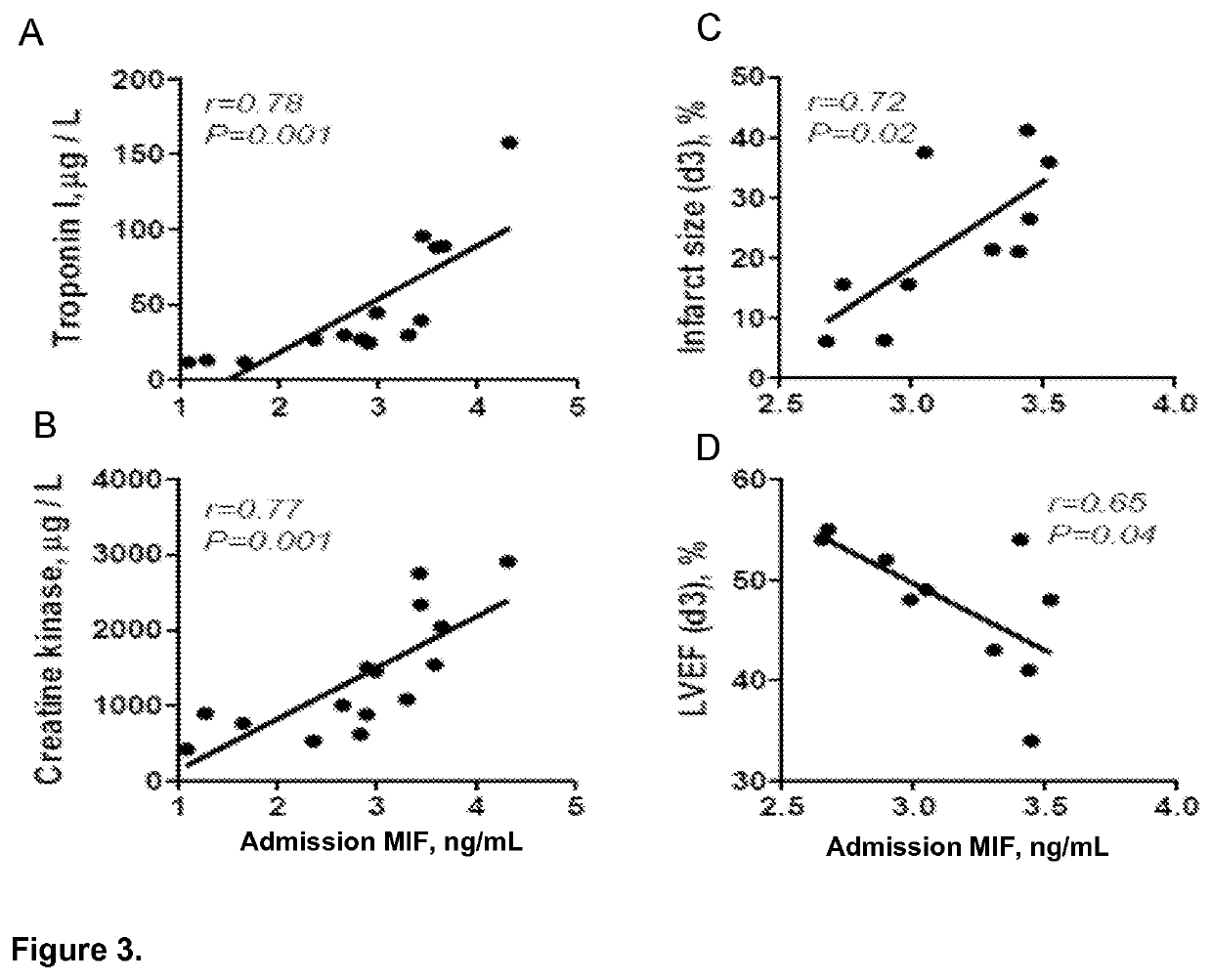 Method for diagnosis, prognosis or treatment of acute coronary syndrome (ACS) comprising measurement of plasma concentration of macrophage migration inhibitory factor (MIF)