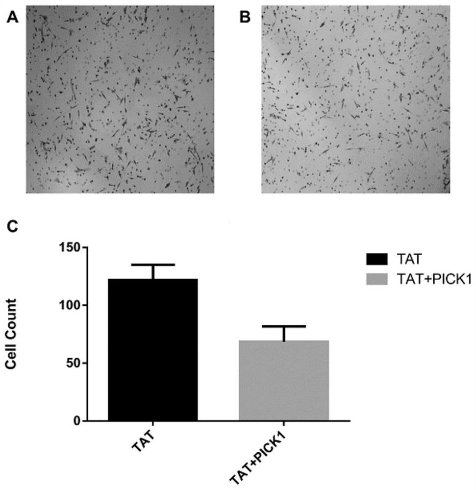 A kind of anti-glioma polypeptide molecule and its application