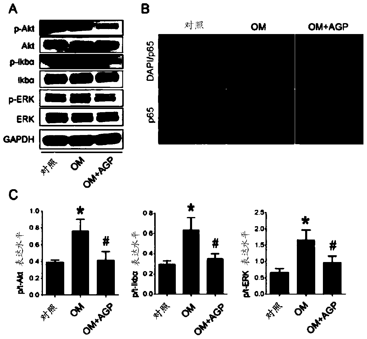 Use of andrographolide in treatment of calcific aortic valve disease