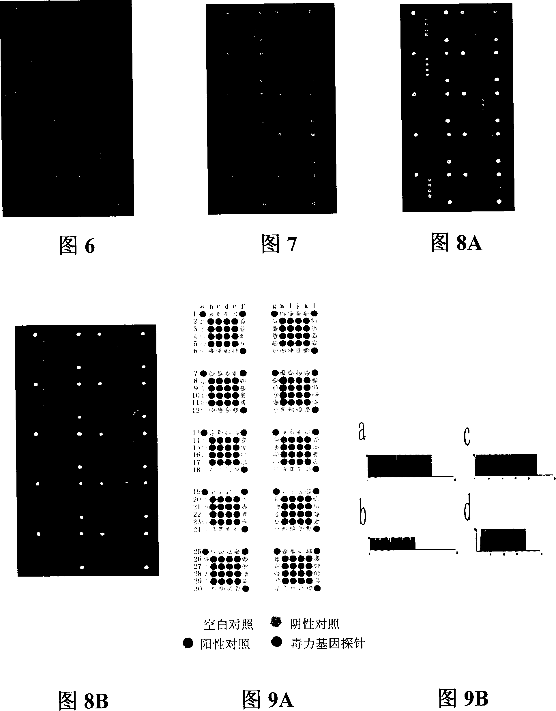 Pathogenic microorganism DNA detecting chip and preparation method and application thereof