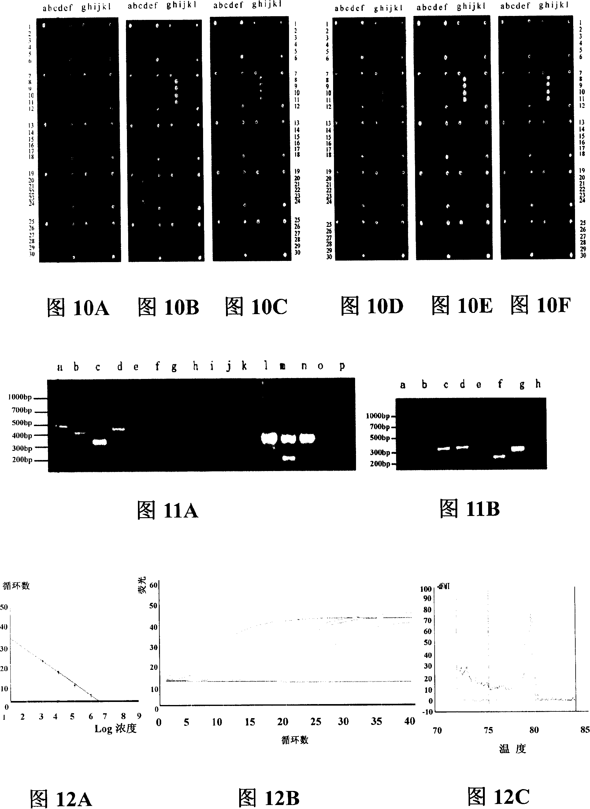Pathogenic microorganism DNA detecting chip and preparation method and application thereof