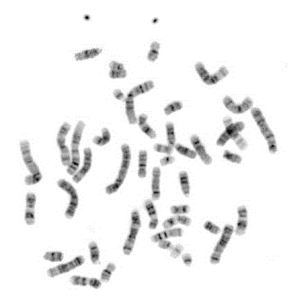 A kind of preparation method of bone marrow chromosome g-band