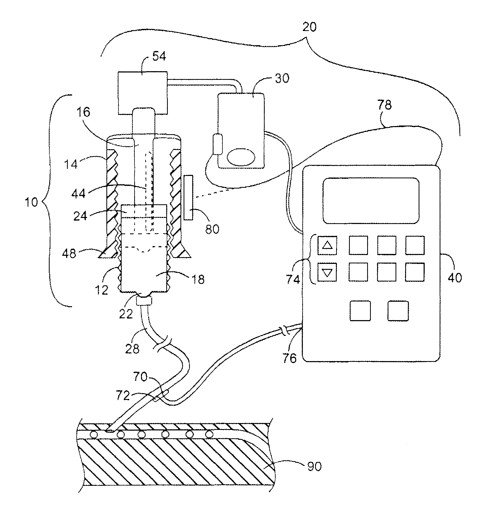 Medical infusion device producing adenosine triphosphate from carbohydrates