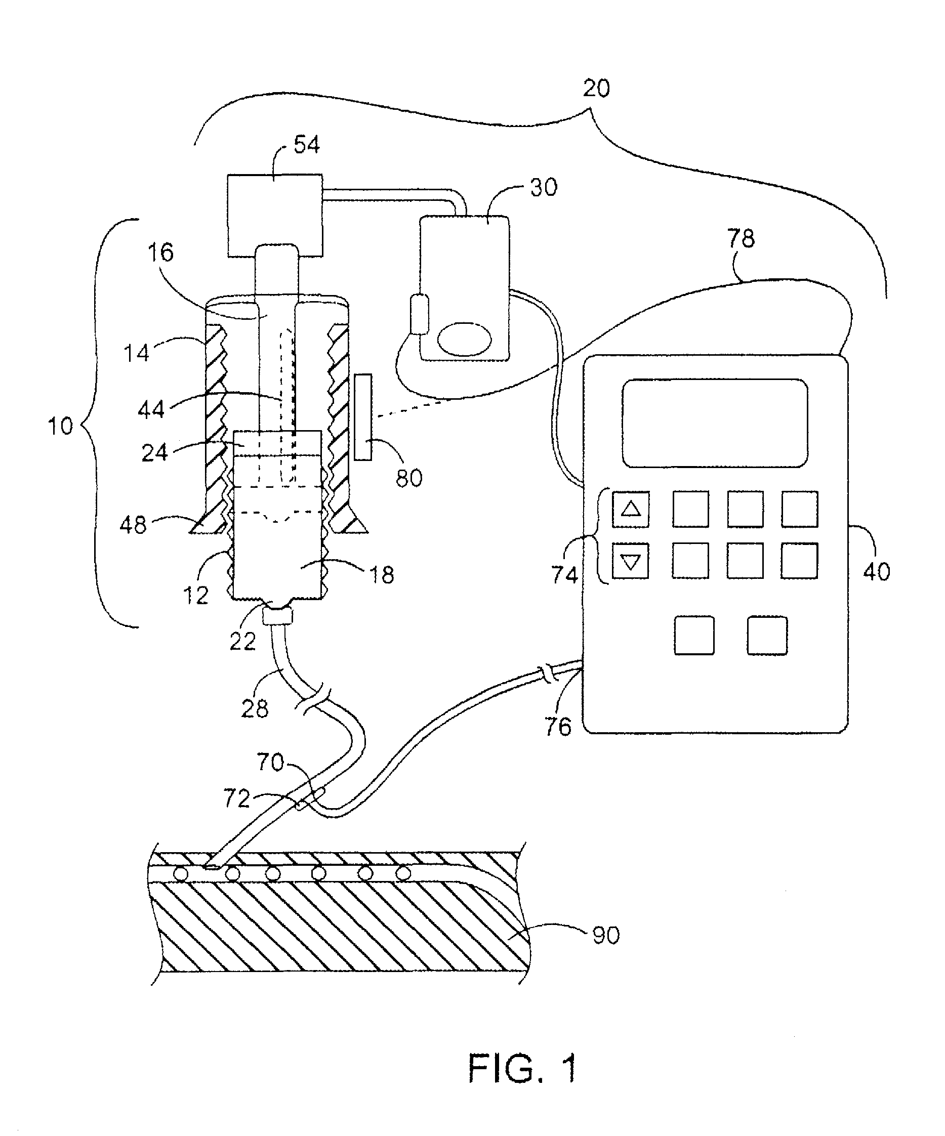 Medical infusion device producing adenosine triphosphate from carbohydrates