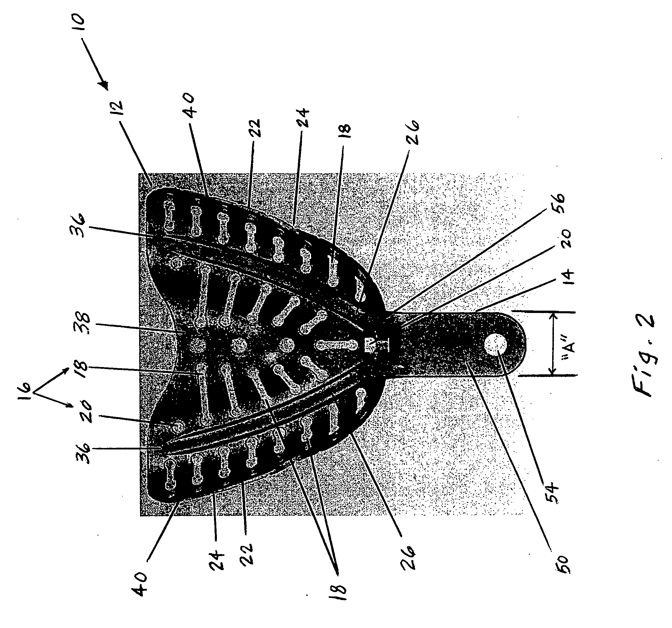 Dental tray for obtaining dental impression of edentulous patient