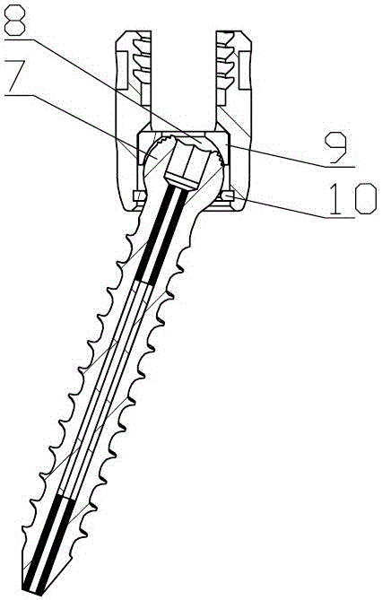 Magnetic navigation pedicle screw