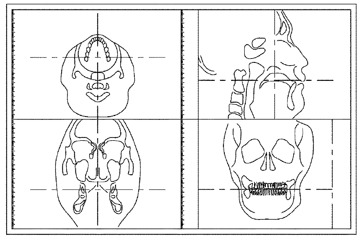 X-ray imaging device and X-ray imaging method