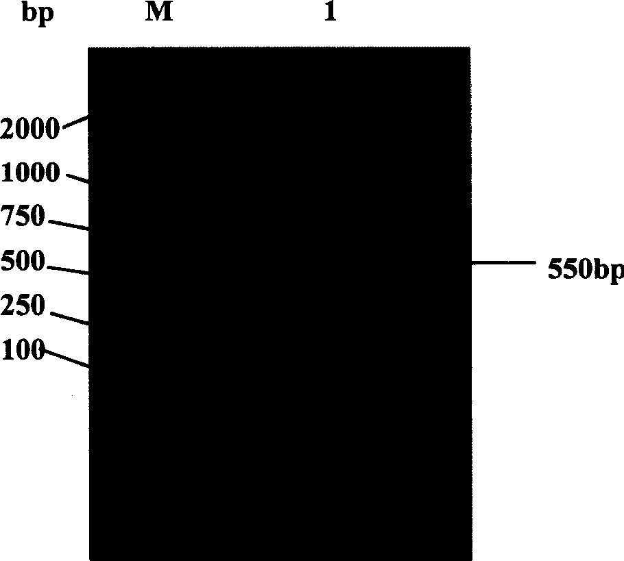 Recombination human endothelium chalene expression strain and solubility expression method