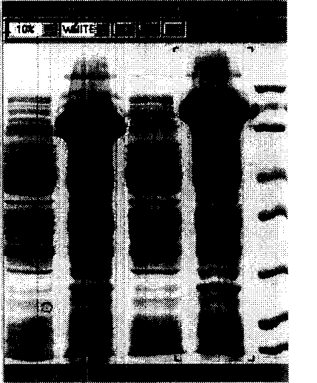 Recombination human endothelium chalene expression strain and solubility expression method