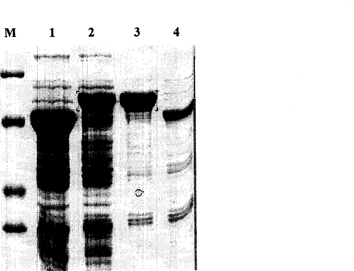 Recombination human endothelium chalene expression strain and solubility expression method