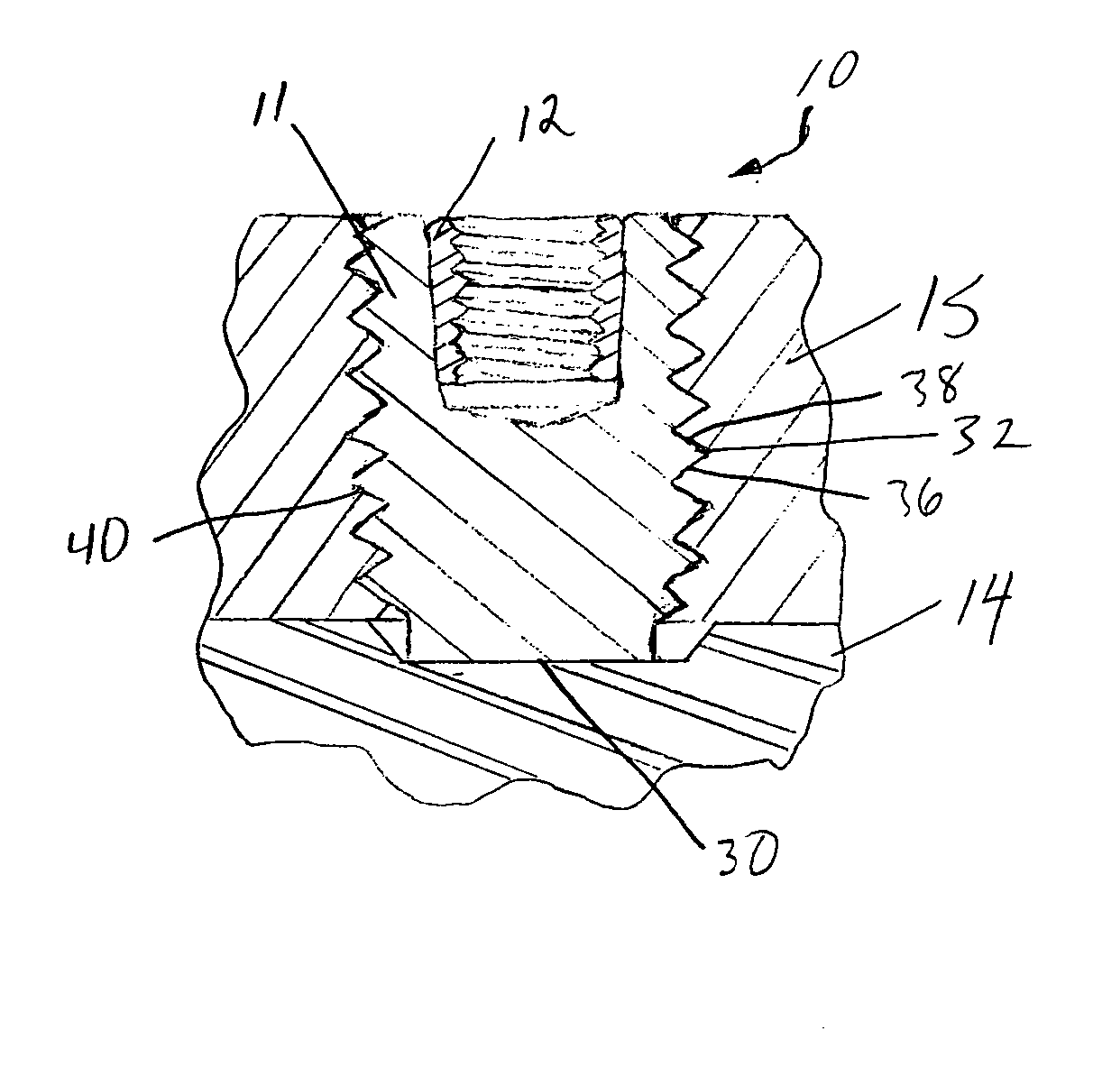 Internally disposed linear fastener system