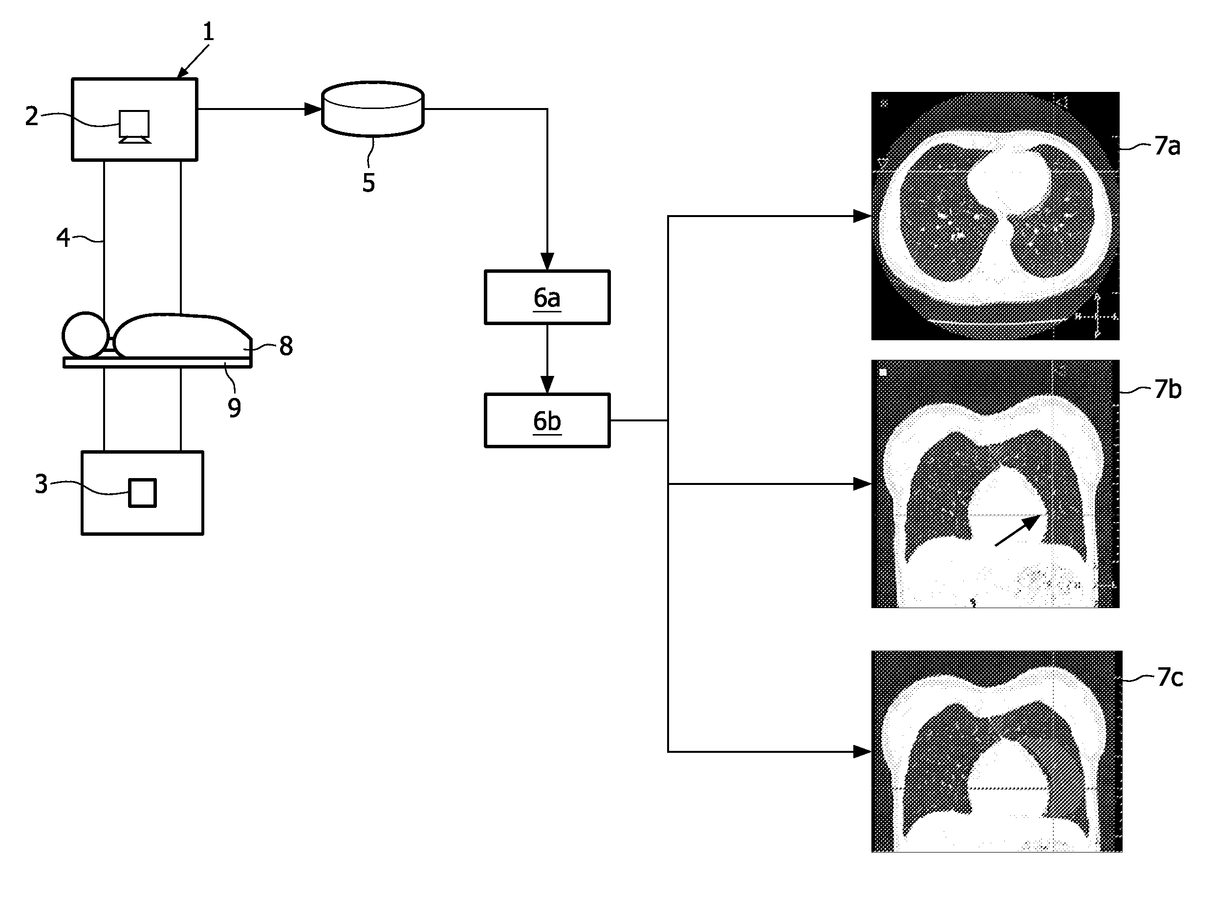 Apparatus and method for indicating likely computer-detected false positives in medical imaging data