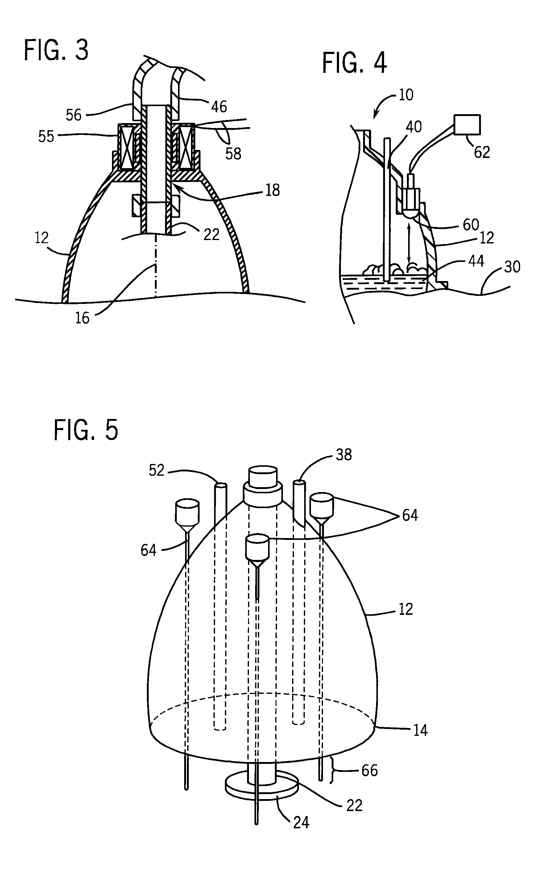 Device for Treatment of Venous Congestion