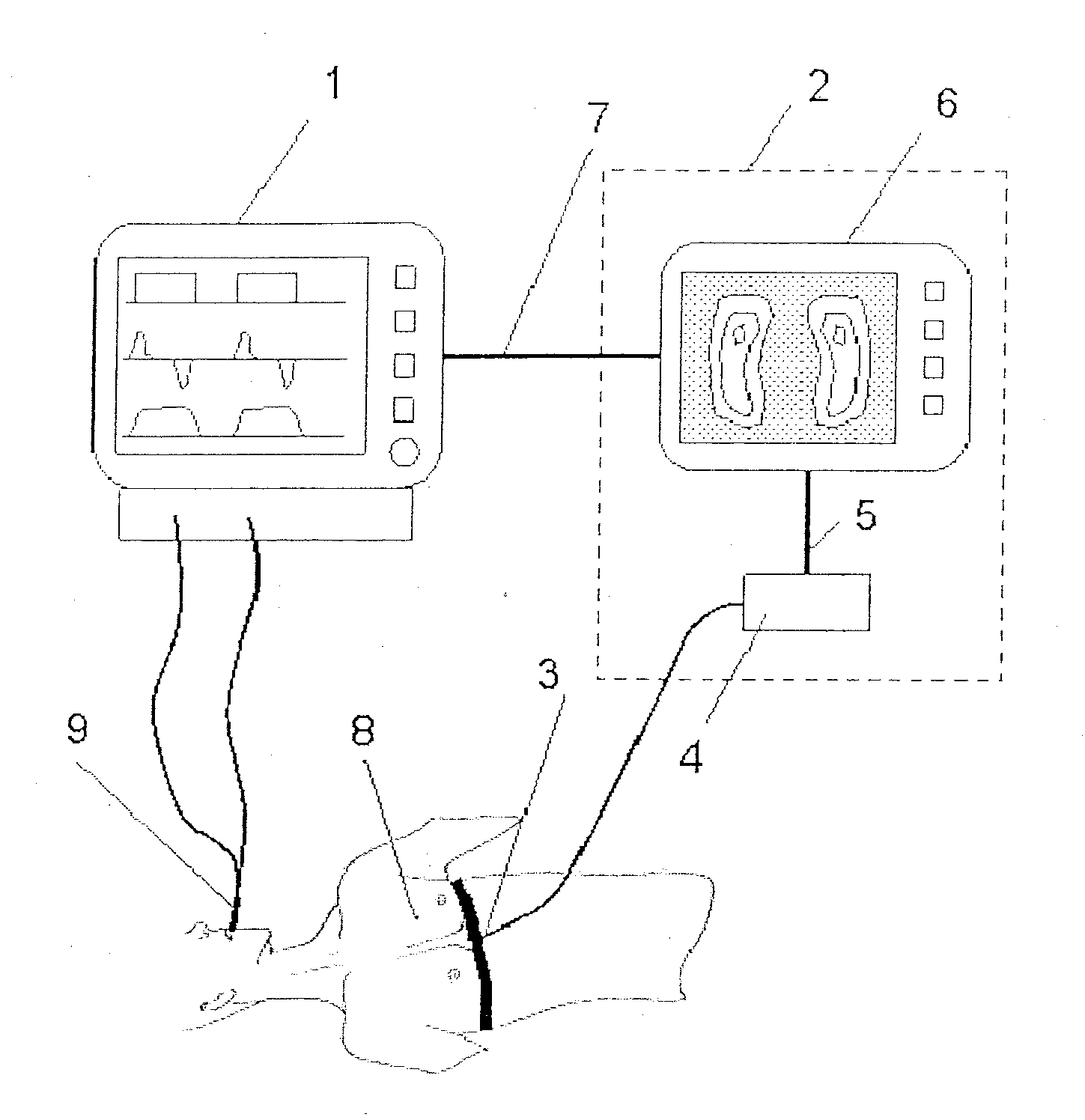 Process and device for lung ventilation