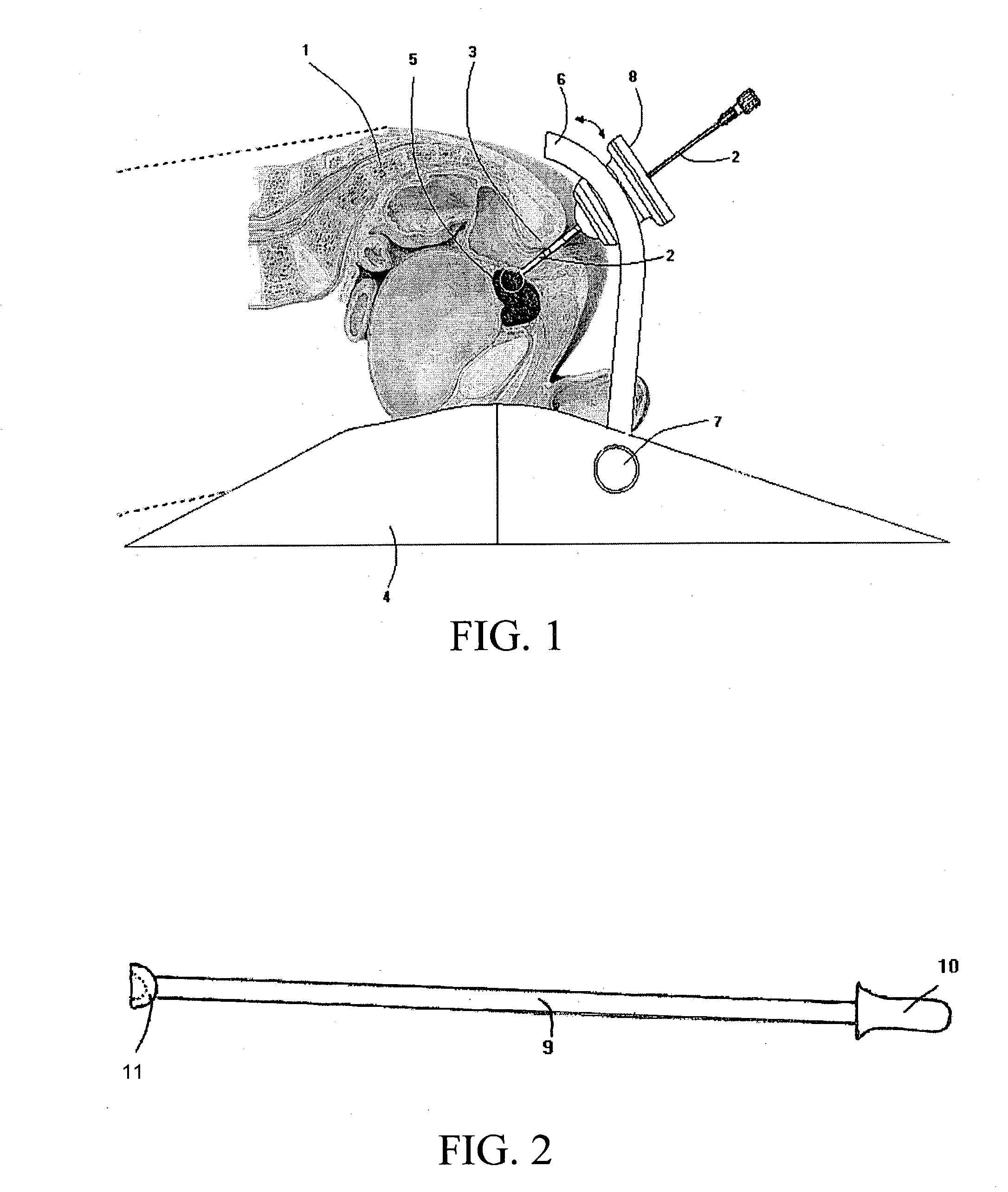Method and apparatus for MR-guided biopsy