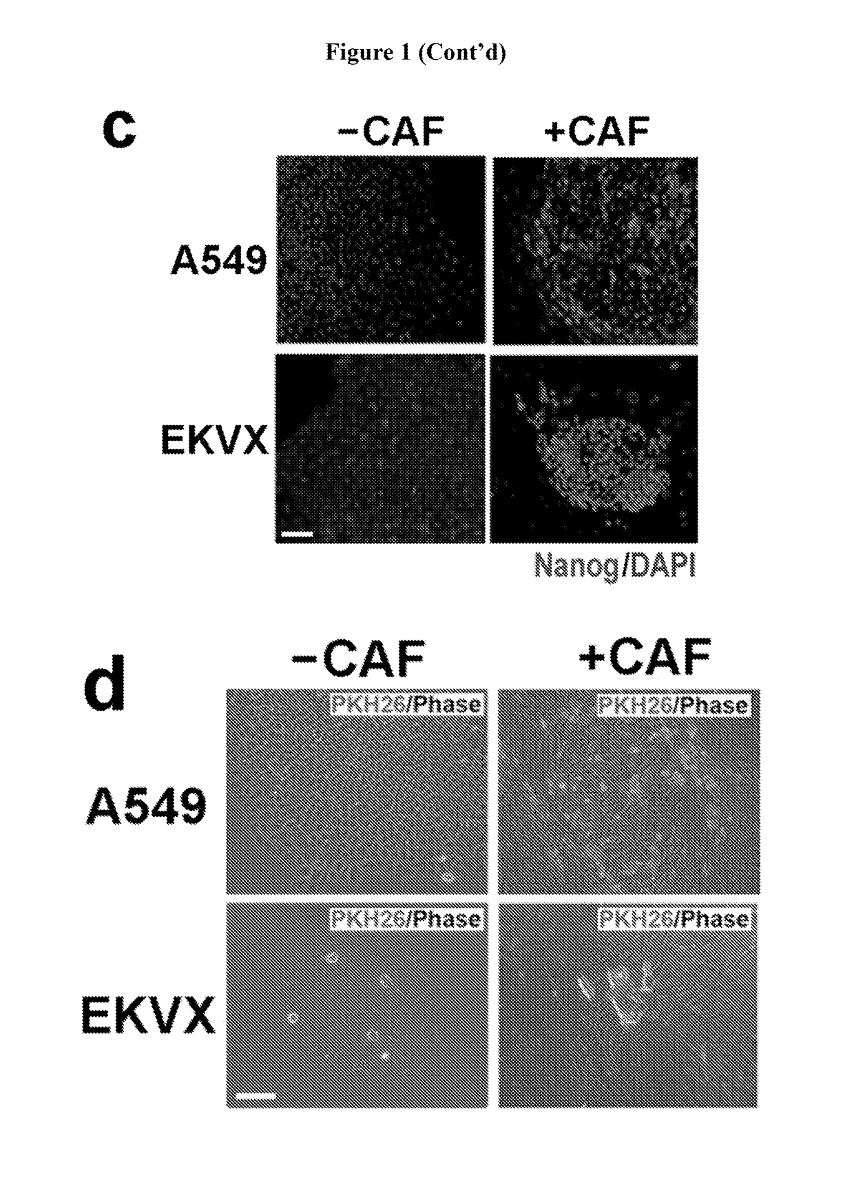 Cancer-associated fibroblasts in maintaining stemness of cancer stem cells