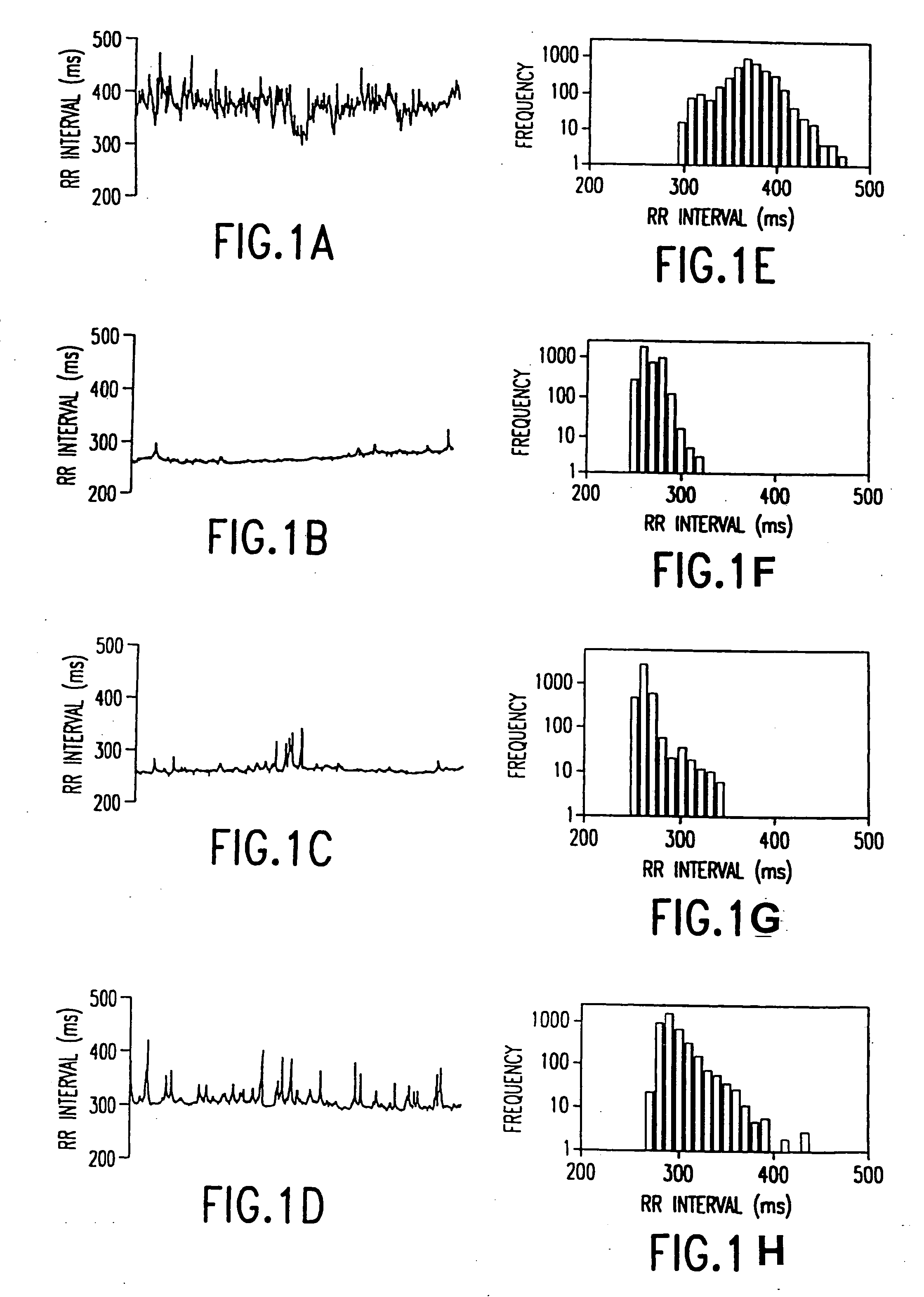 Method and apparatus for the early diagnosis of subacute, potentially catastrophic illness