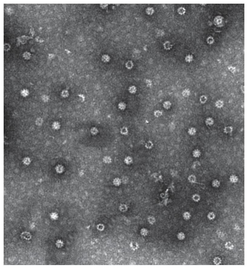 Novel coronavirus vaccine based on chimeric virus-like particles