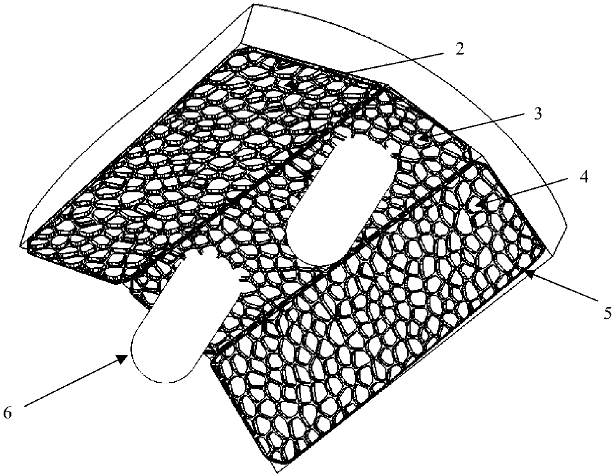 Personalized porous structure astragalus restoration, osteotomy surgical guide plate and design method thereof