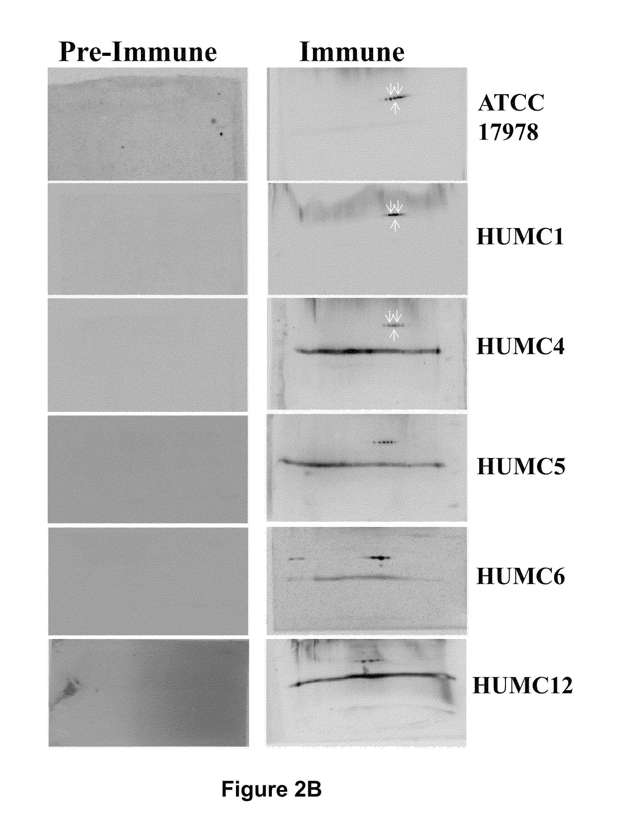 Compositions and methods for immunization against drug resistant <i>Acinetobacter baumannii</i>