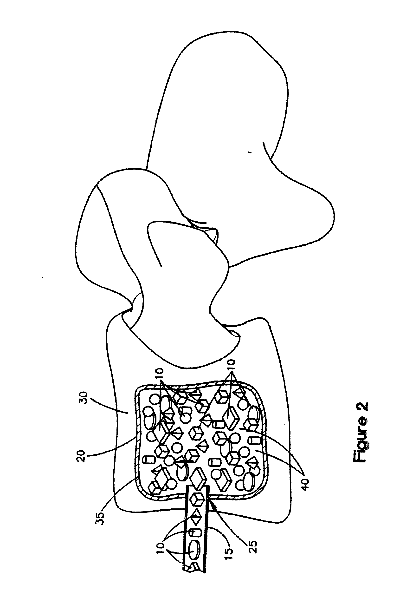 Demineralized cortical bone implants