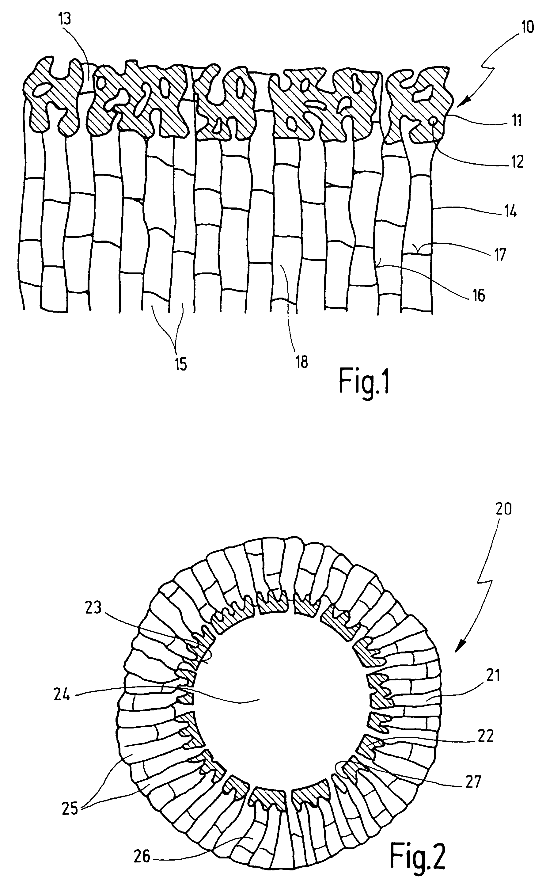 Implant and process for producing it