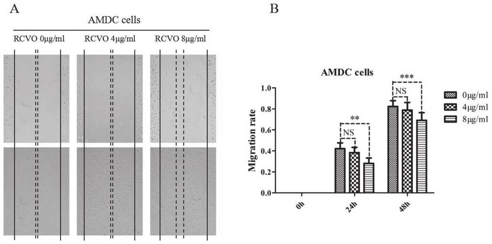 Application of Guizhi Zhonglou Xuejie Extract in the Preparation of Drugs for Adenomyosis