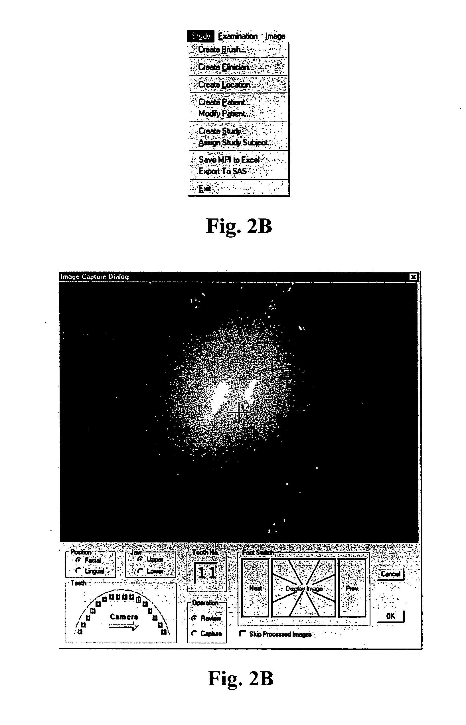 Computer-implemented system and method for automated and highly accurate plaque analysis, reporting, and visualization