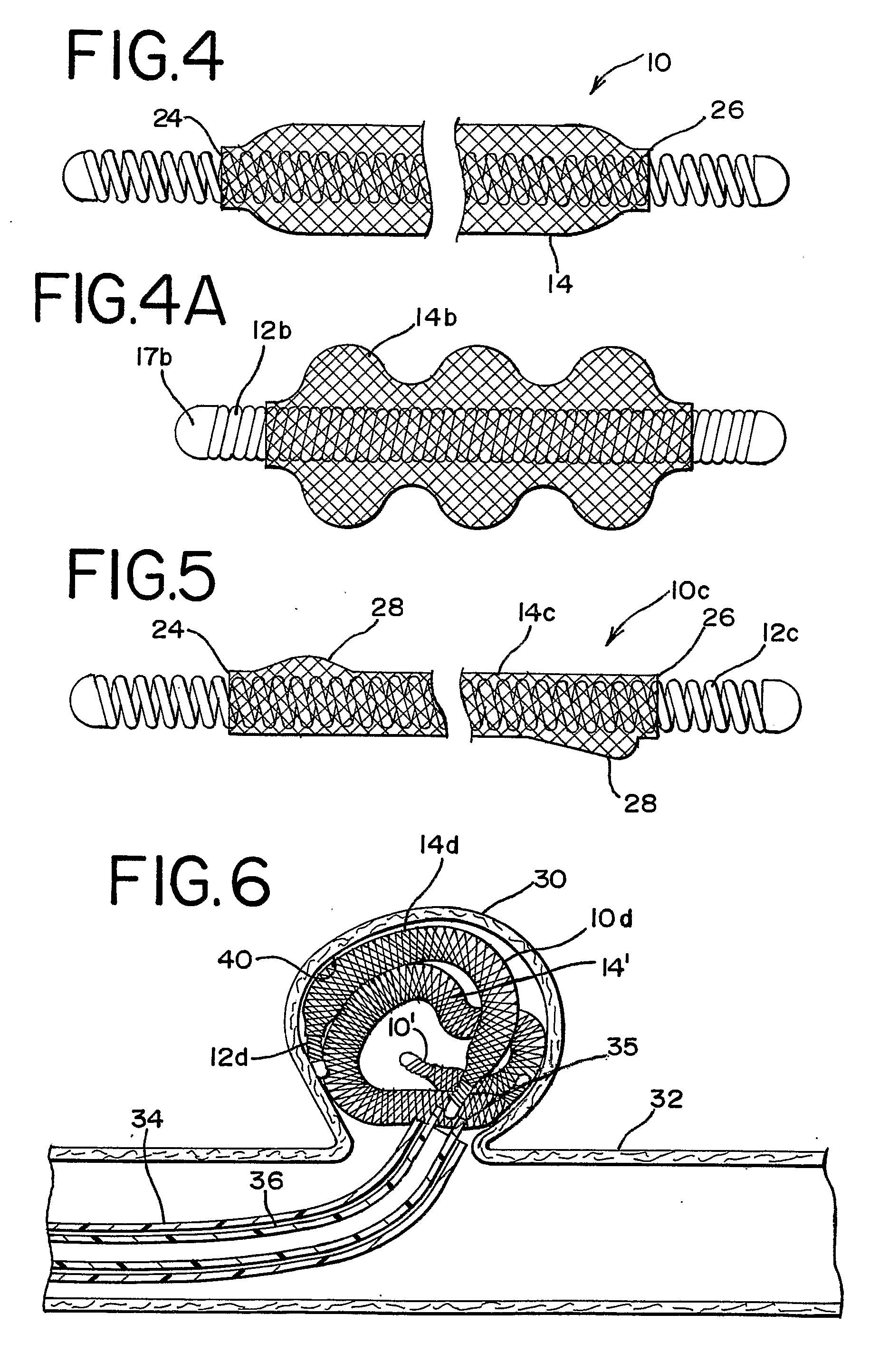 Expandable Vascular Occlusion Device