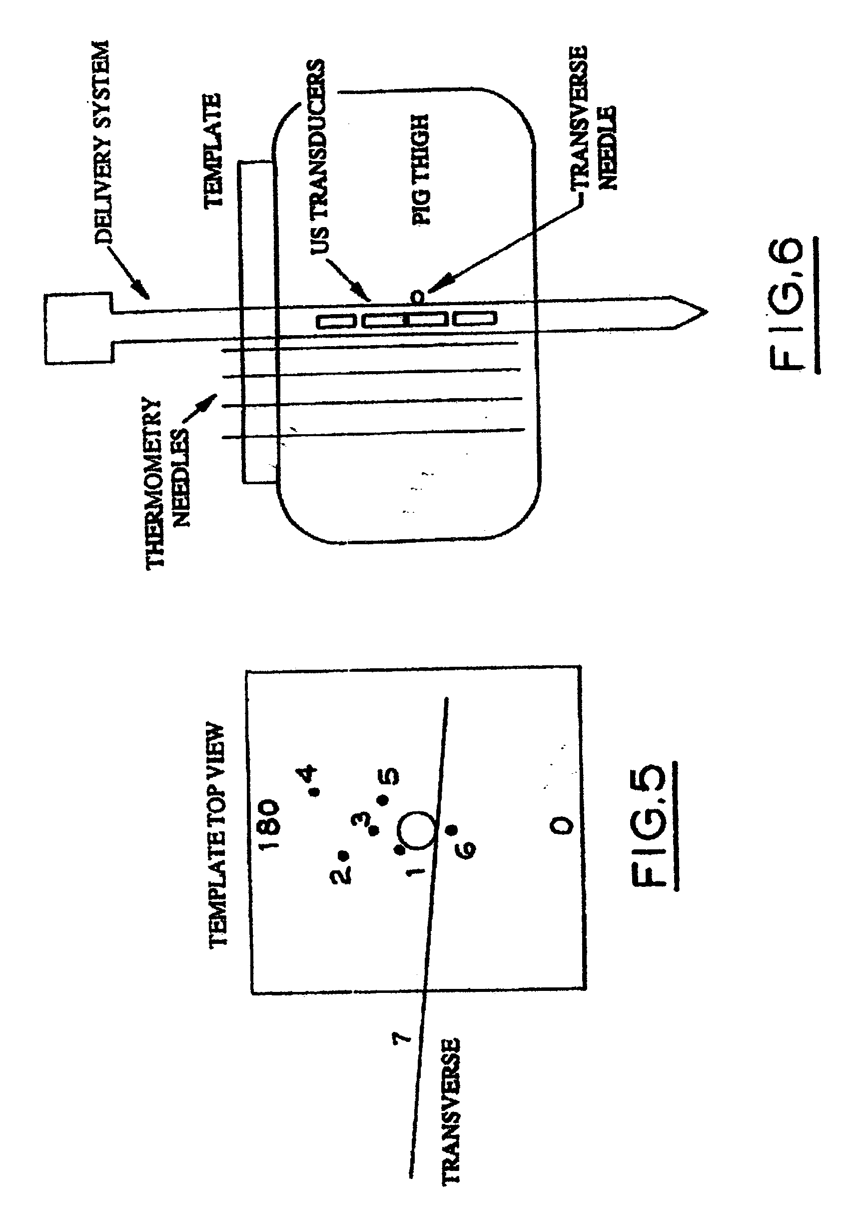 Method of manufacture of a transurethral ultrasound applicator for prostate gland thermal therapy