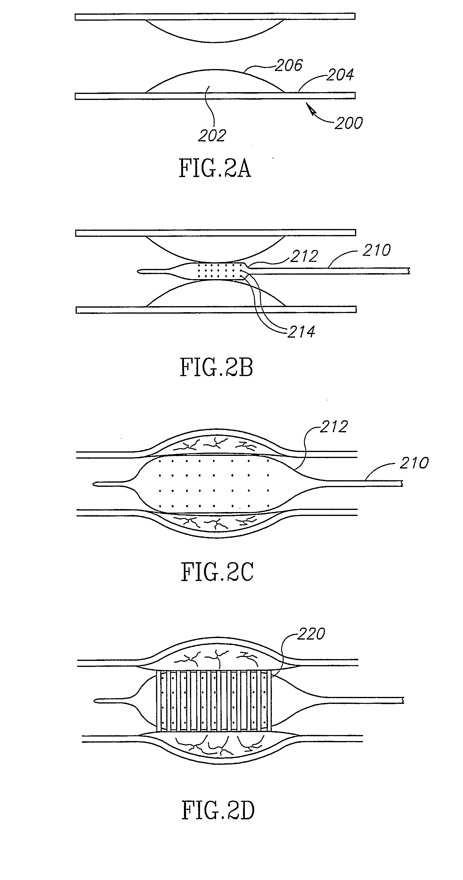 Material Delivery System