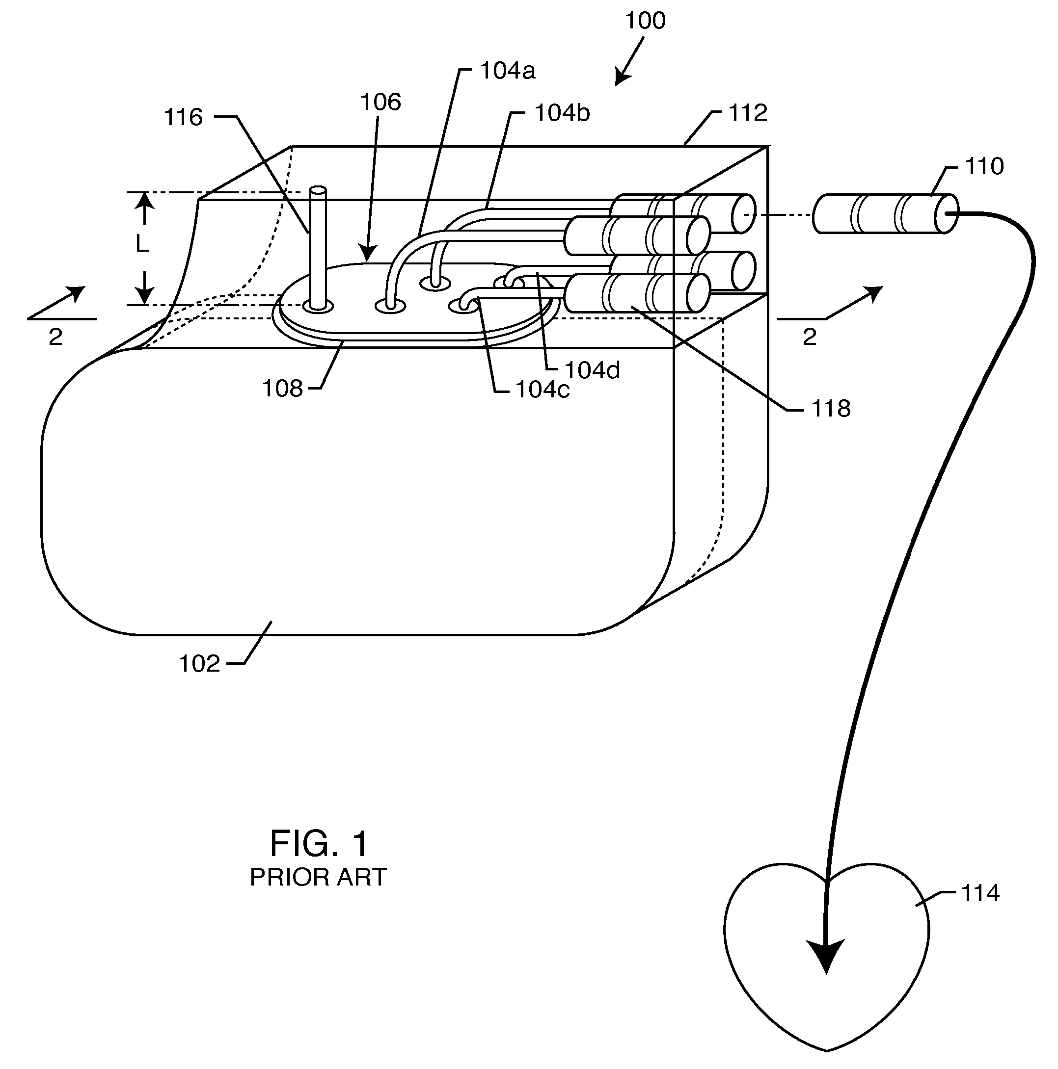 Low loss band pass filter for RF distance telemetry pin antennas of active implantable medical devices