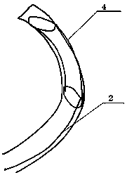 Novel split intracranial covered stent system and use method thereof