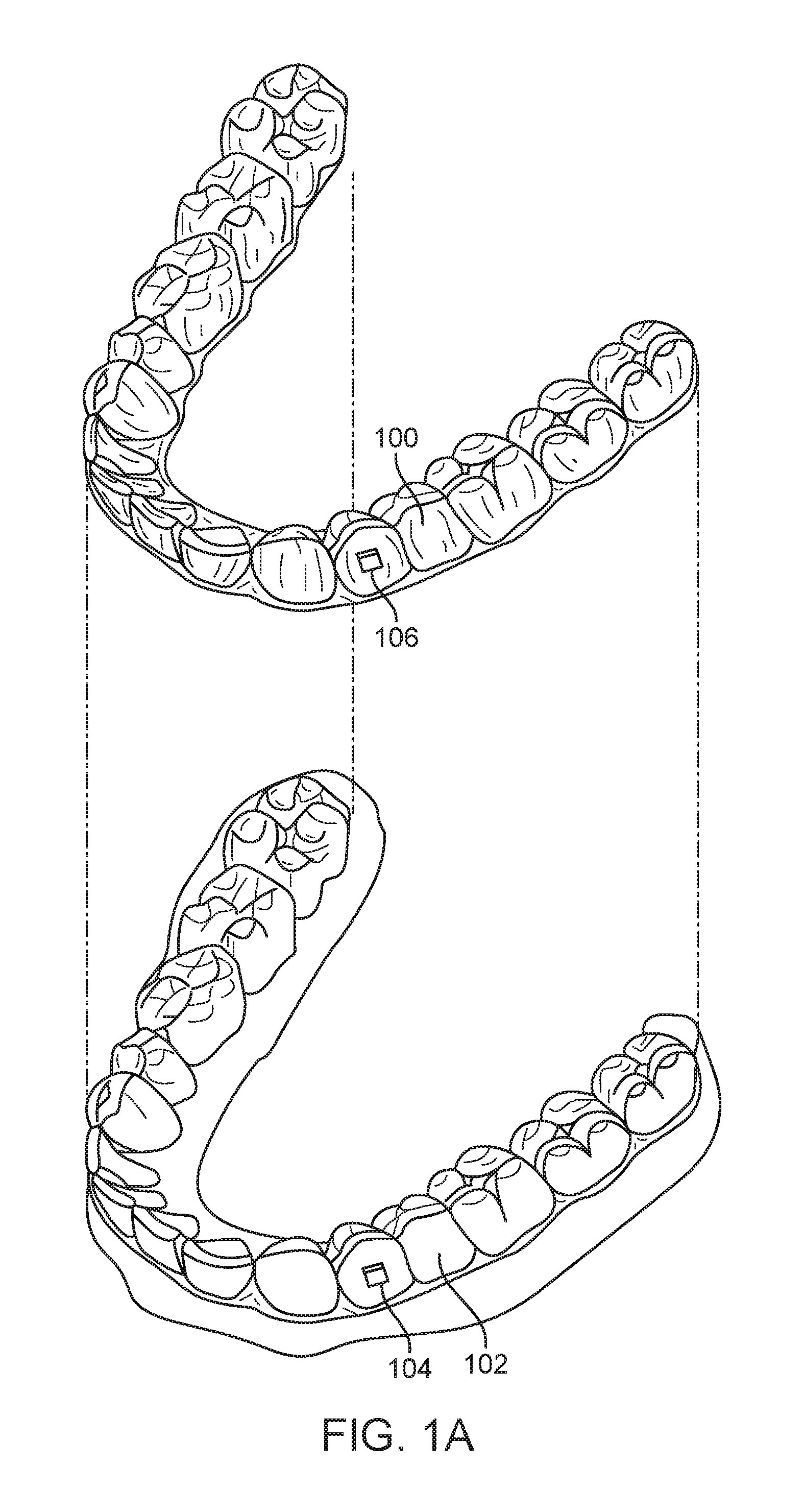Direct fabrication of aligners with interproximal force coupling