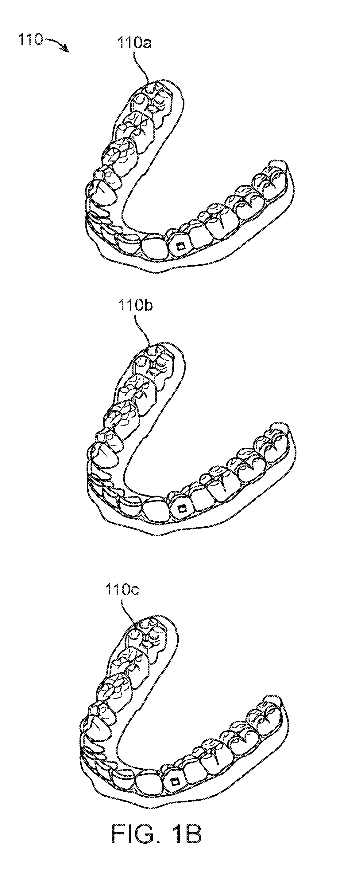 Direct fabrication of aligners with interproximal force coupling