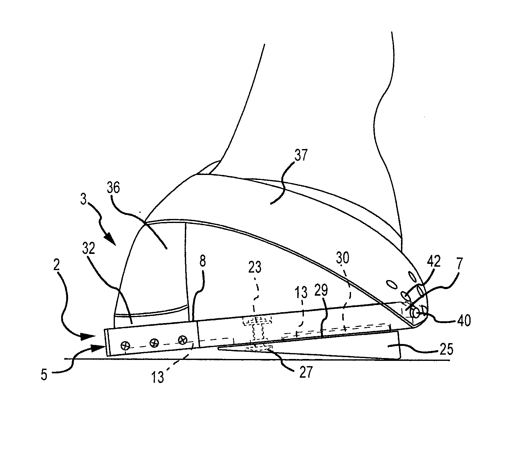 Apparatus And Method For Diagnostic Leverage Testing Of Equine Distal Limb
