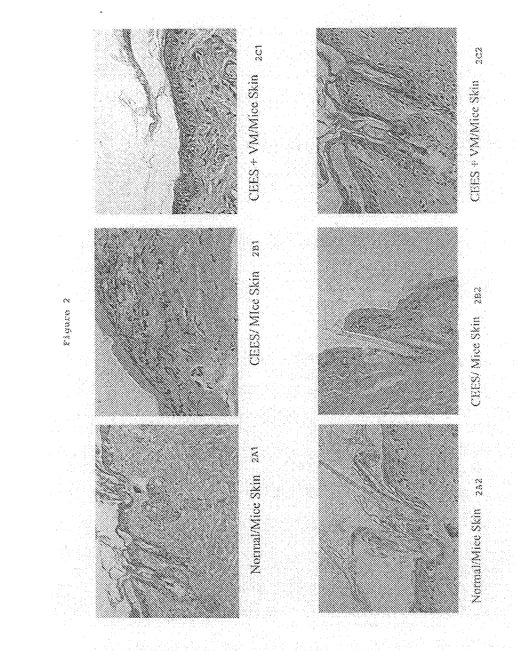 Composition for treating sulfur mustard toxicity and methods of using same