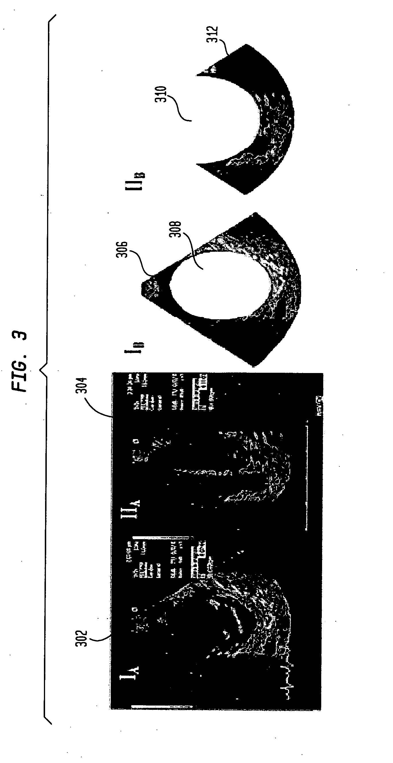 System and method for local deformable motion analysis